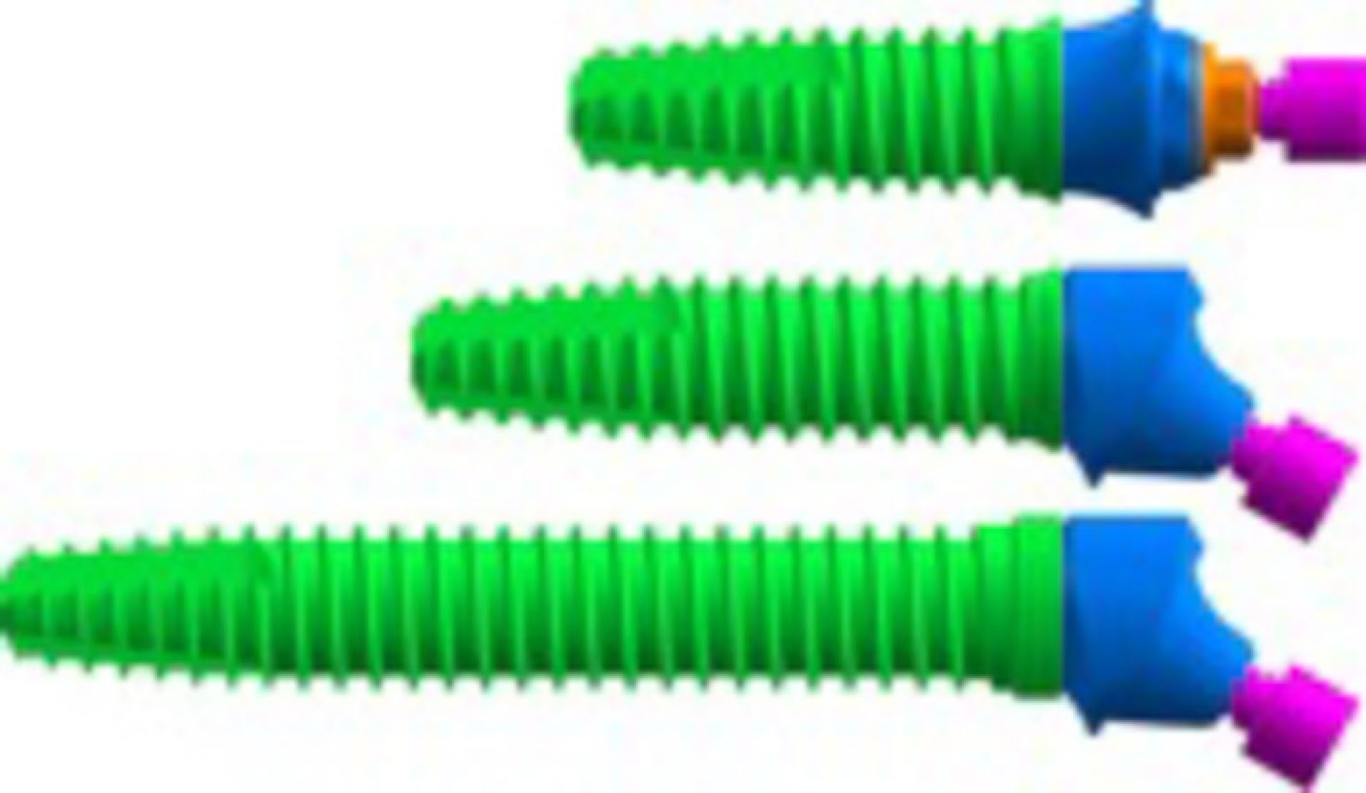 Medical Science Monitor  Biomechanical Behavior of All-on-4 and M-4  Configurations in an Atrophic Maxilla: A 3D Finite Element Method - Article  abstract #929908